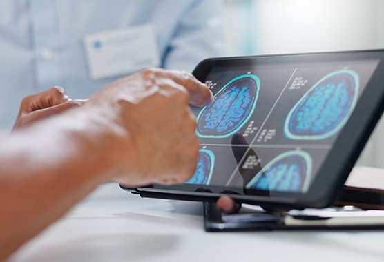 tablet showing mri scans